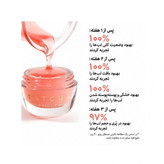 پک لب سفورا مدل perfect pout lip set