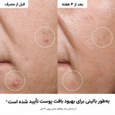 پک آرایشی سفورا مدل prep and set